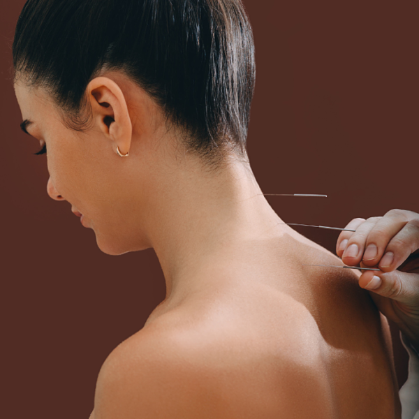 Acupuntura Sistêmica e Estética: Harmonia e Beleza através de Técnicas Milenares